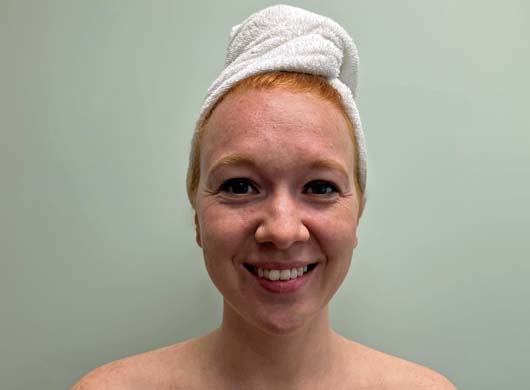 Facial Before